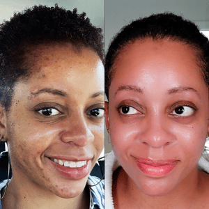 BeforeAndAfter-MyStory